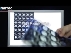 Inkjet Medical Imaging Film for X-ray CT MRI UltraSound