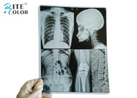 10 * 12 Inch PET Medical Imaging Film Dry X Ray Film For Inkjet Printers
