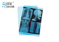 Medical Blue Sensitive X Ray Film PET Material For Image Inkjet Printing