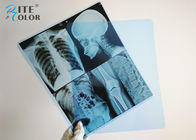 Inkjet Blue Radiology Medical Imaging Film