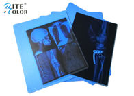 Inkjet PET Medical Imaging Blue X Ray Film For Canon Pixma Printers