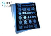 Plastic Clear Inkjet Medical X Ray Film Waterproof Blue Color 215mic