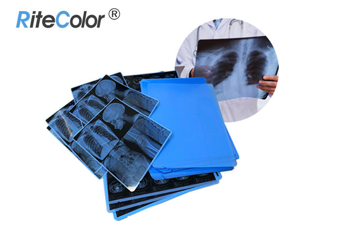 Inkjet Laser Printing X Ray Sheet Film Medical Dry Imaging Film 210 Micron Thickness