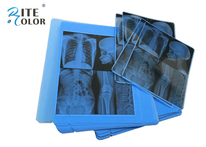 Radiology Blue X Ray Medical Imaging Film 210um Thickness For Epson Inkjet Printer