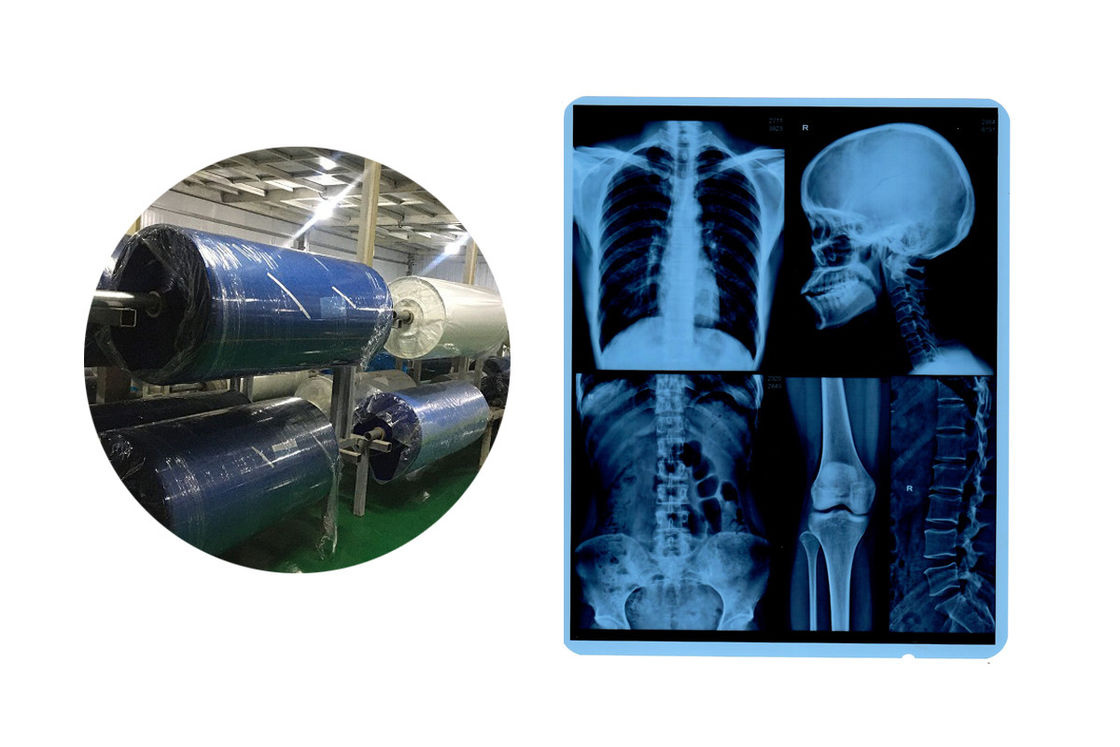 8x10 210 Micron Blue Base X Ray Medical Imaging Film