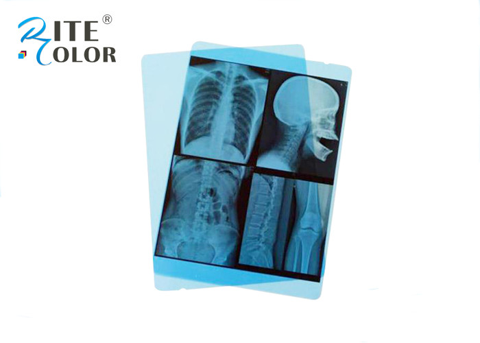 Medical Blue Sensitive X Ray Film PET Material For Image