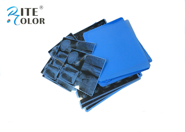 Medical Blue Sensitive X Ray Film PET Material For Image