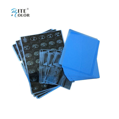 Inkjet Printing PET Blue Medical Film For X Ray A4 8x10 14x17 Sheets