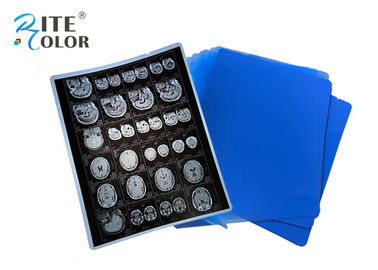 PET Base X Ray Sheet Film Radiology Imaging Film For DR CT 100 Sheets Per Pack