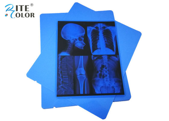 Low Fog A4 Blue PET Dry Pigment Inkjet 210 Micron Medical X Ray Film Eco Friendly