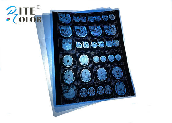 Waterproof PET Blue Medical X Ray Film For MRI CT CR Dental Panorama Images Output