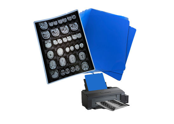 210um 8x10 A3 A4 Blue Medical Inkjet Film For Radiology X-Ray Imaging Output